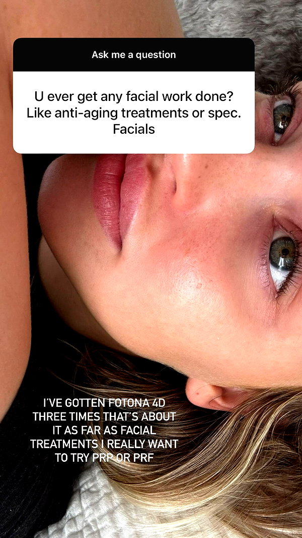 itsbabytana instagram image archive image