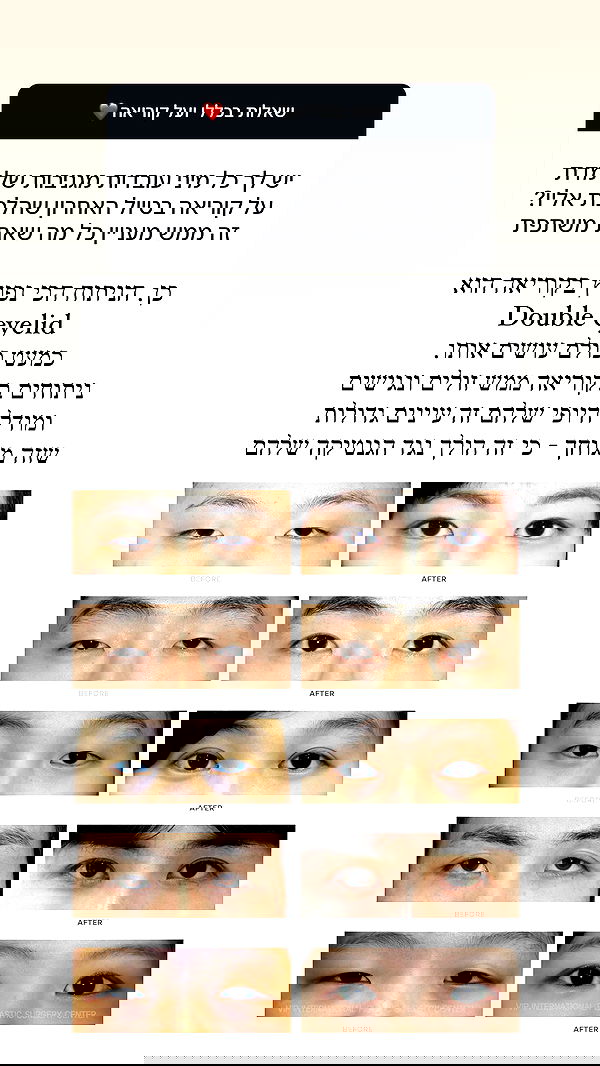 itsilanosh itsilanosh archive image