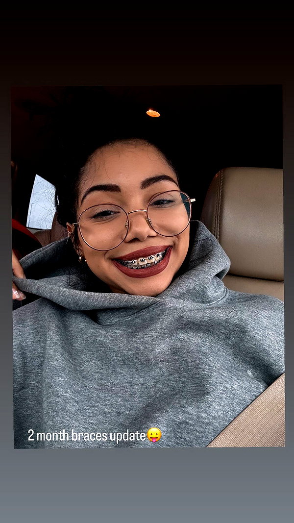 jeanlouiee instagram image archive image