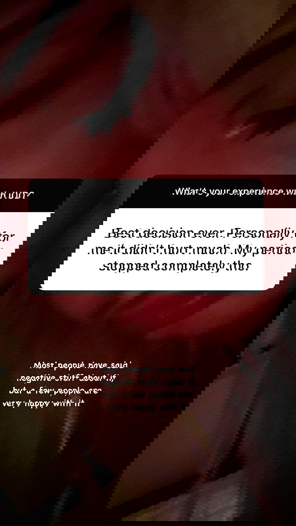 ratskeleton ratskeleton archive image