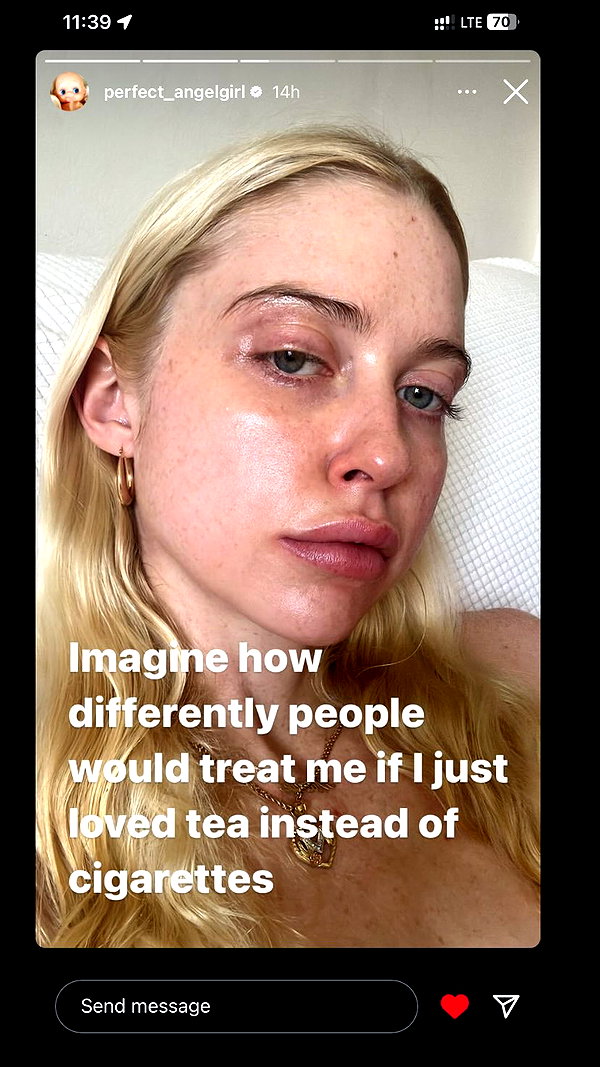 xxk1tty4nnaxx instagram image archive image