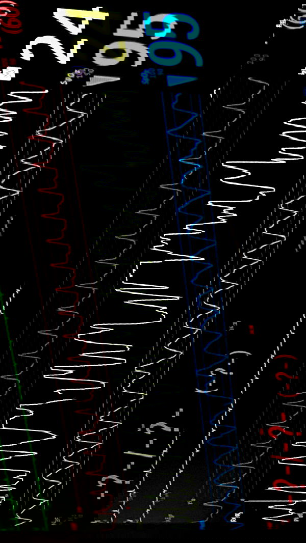 xzot1_met4xx image ~ Altpins