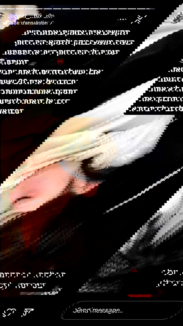 xzot1_met4xx image ~ Altpins