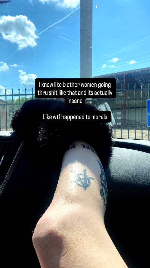 braainr0tt instagram image archive image