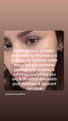 braainr0tt Altpins Profile Picture
