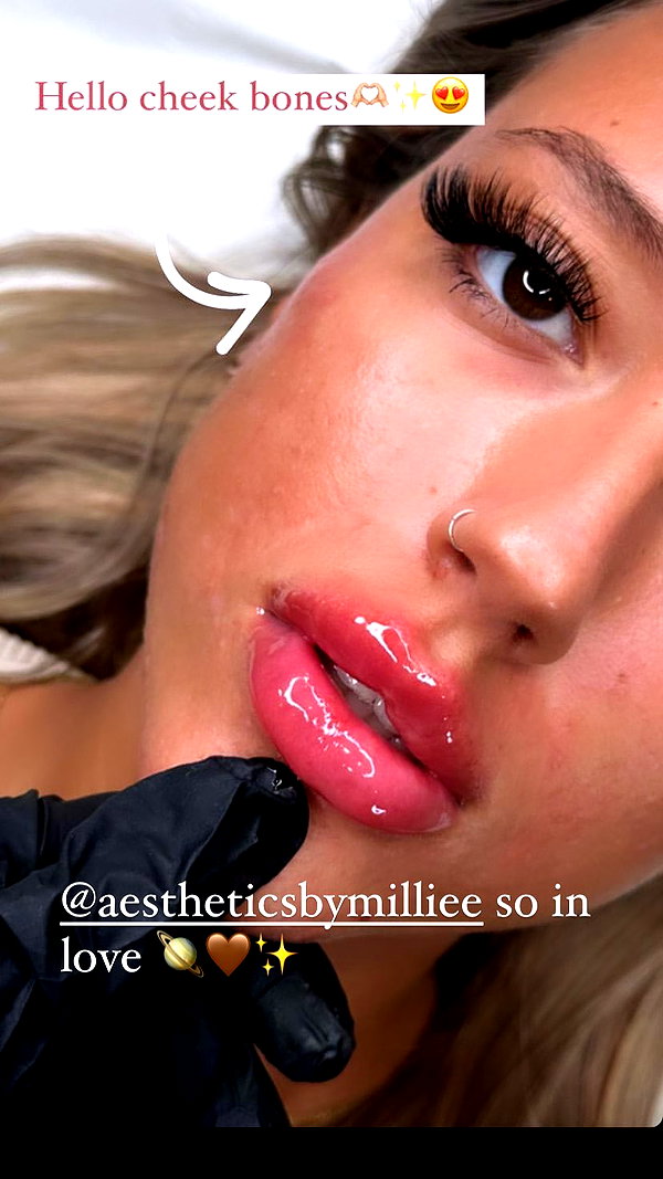chlochristienx chlochristienx archive image