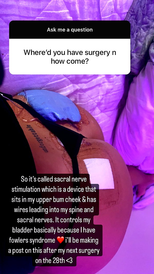 chloelilsxx instagram image archive image