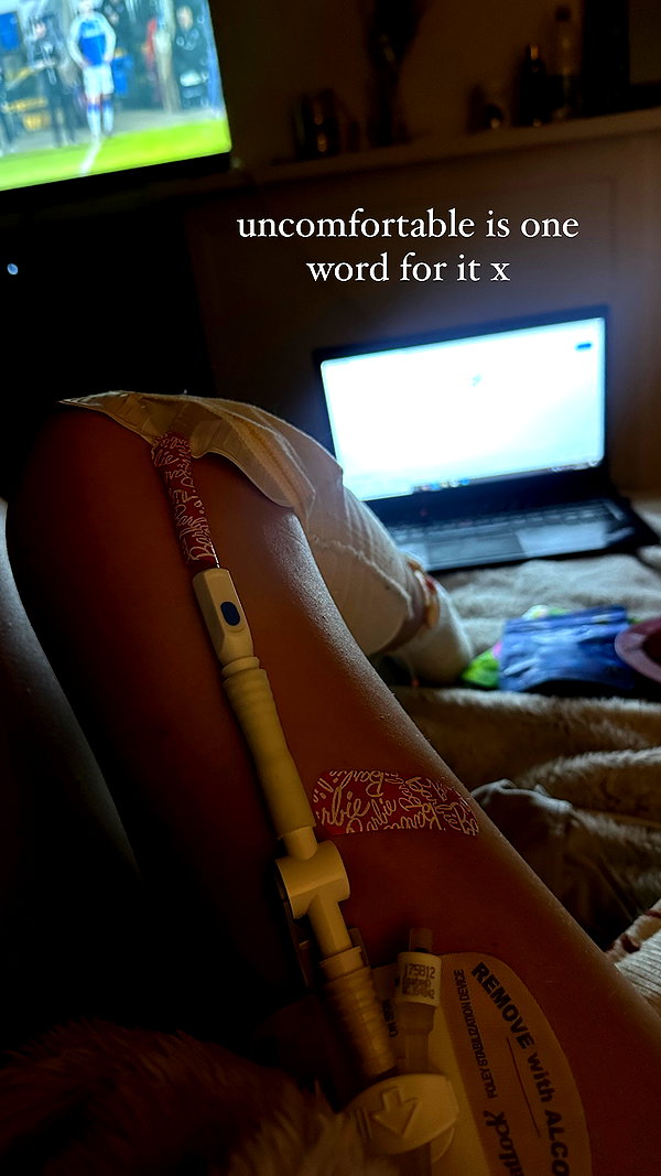 chloelilsxx instagram image archive image