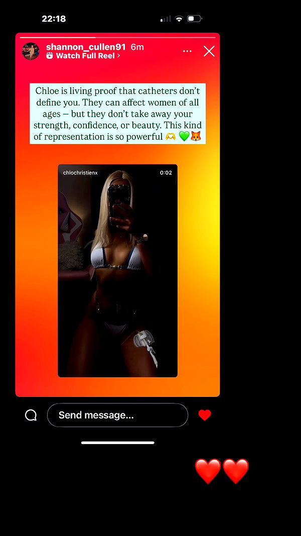 chloelilsxx instagram image archive image
