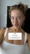 frecklesalanna Altpins Profile Picture