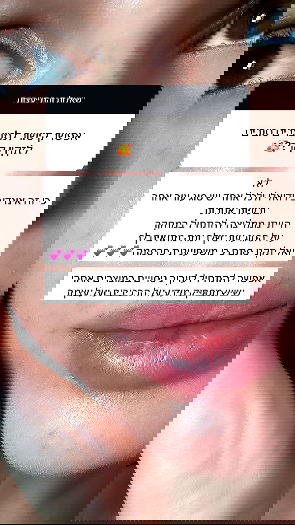 itsilanosh itsilanosh archive image