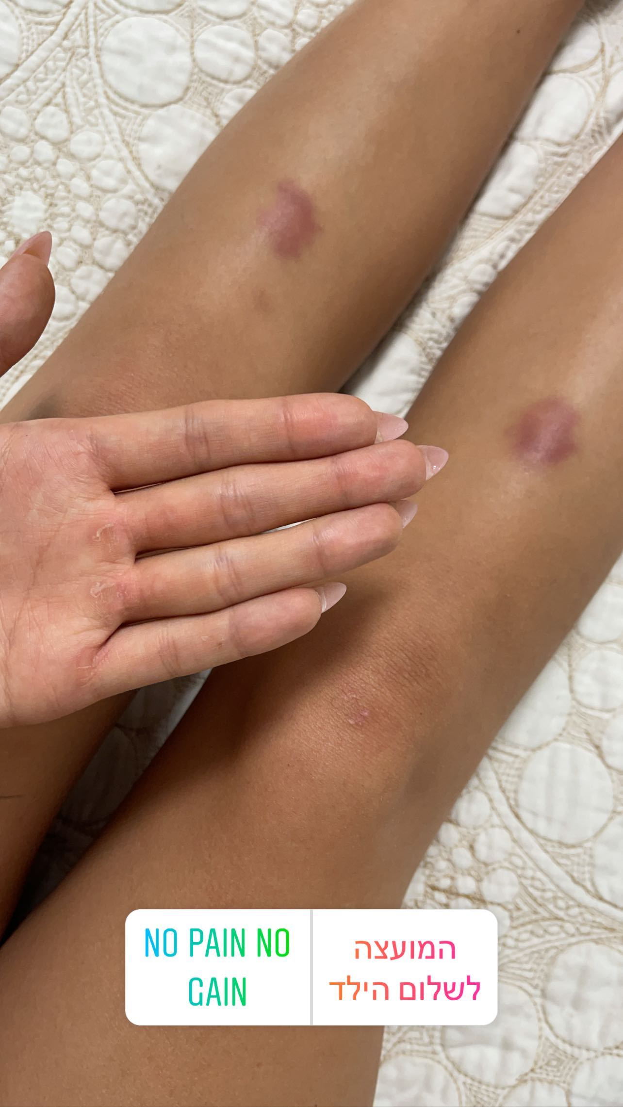 kesemgreenyer instagram image archive image