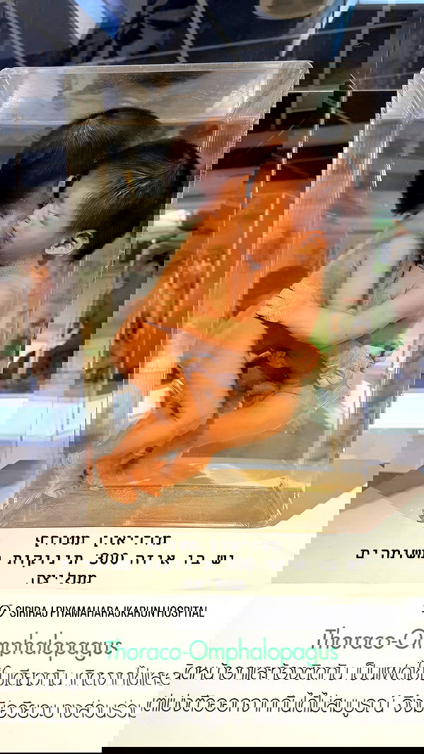 kesemgreenyer image ~ Altpins