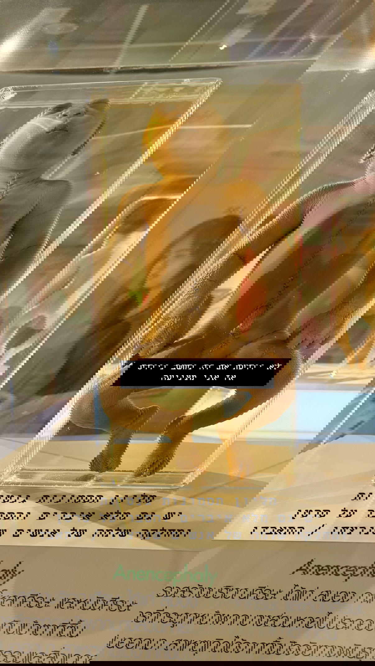 kesemgreenyer instagram image archive image