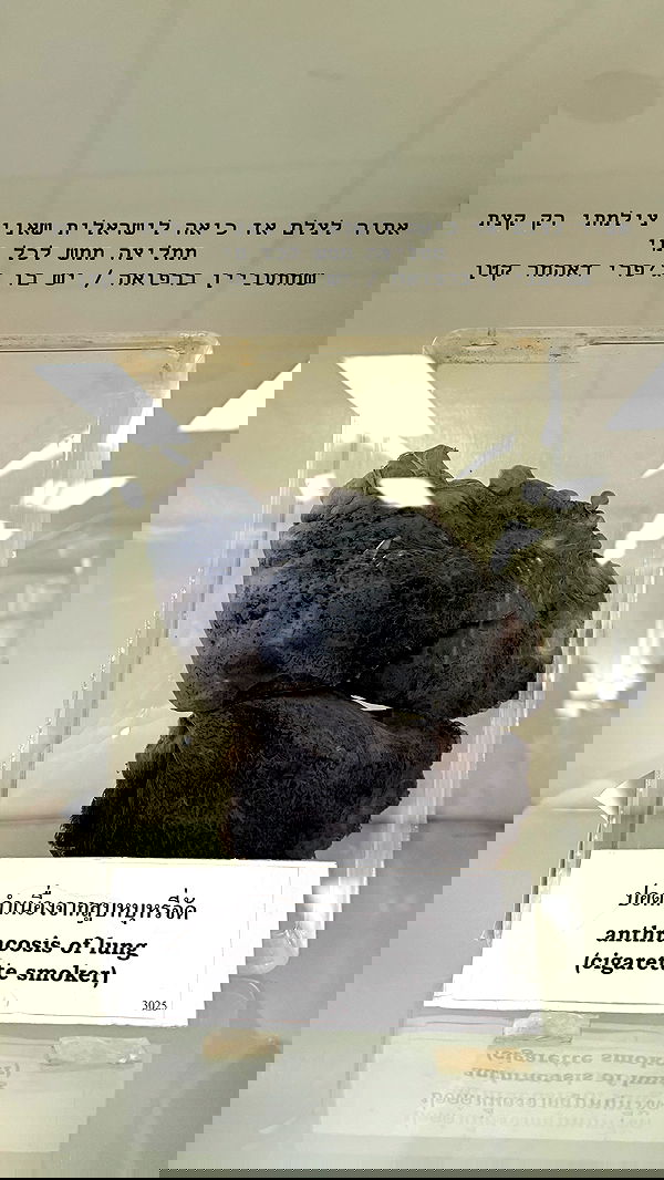 kesemgreenyer image ~ Altpins