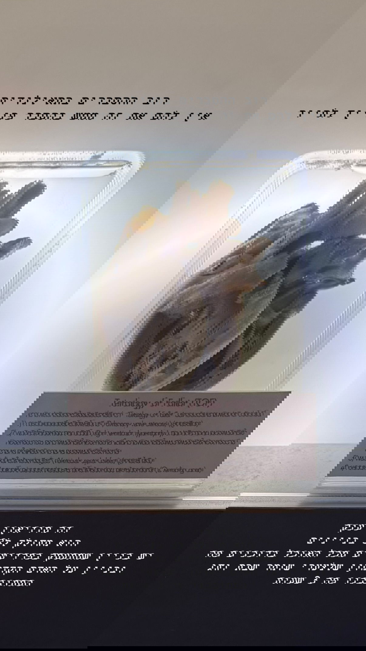 kesemgreenyer instagram image archive image