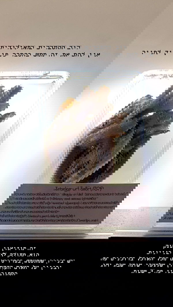 kesemgreenyer image ~ Altpins