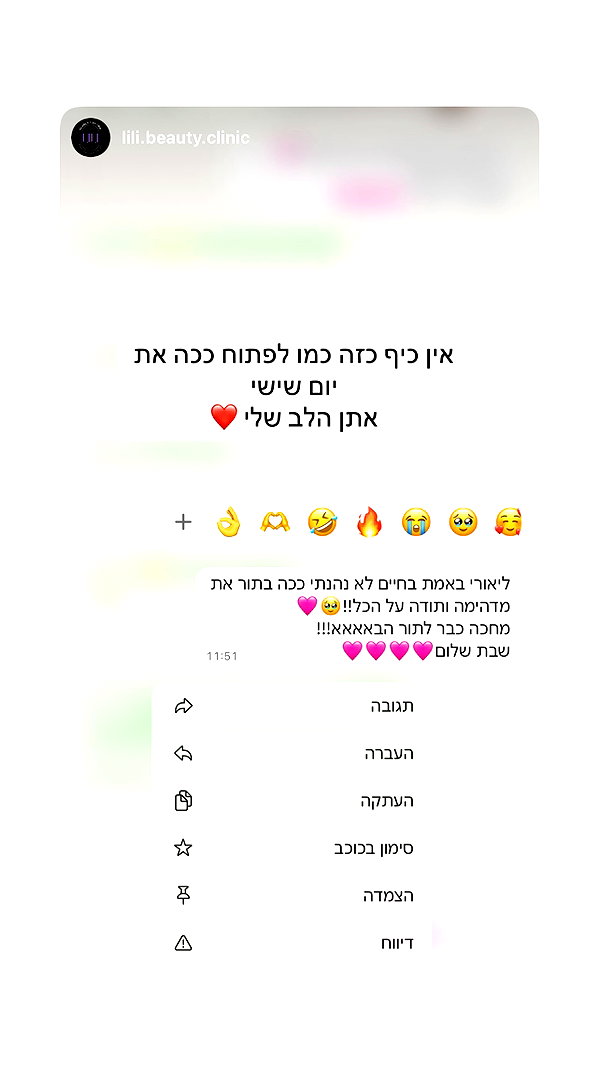 lior_lotati instagram image archive image