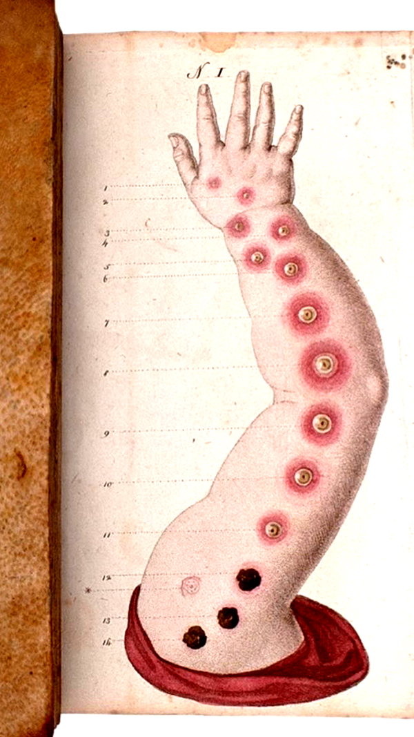 novahnovielli novahnovielli archive image