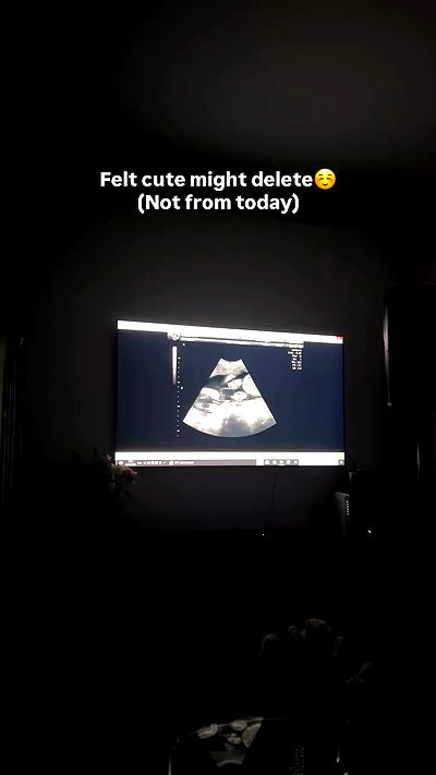 tuliprivet tuliprivet archive video