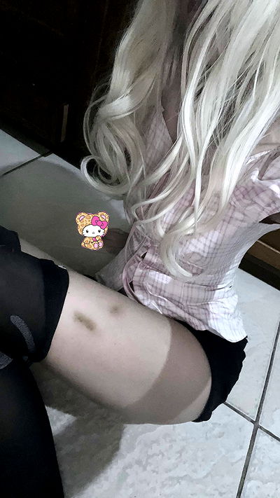 starttles starttles archive video