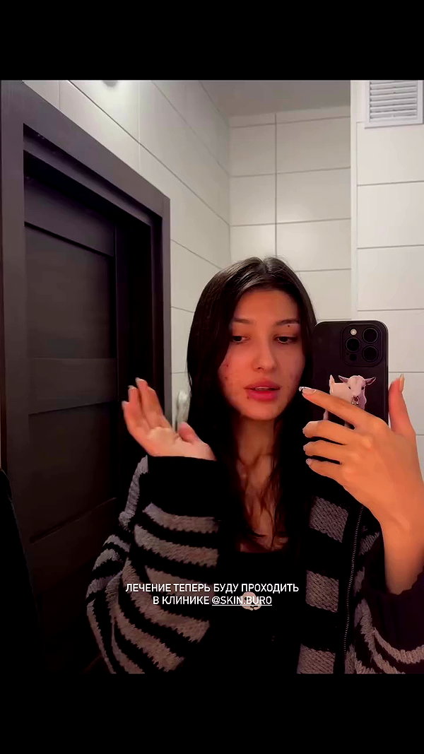 ayguldavlletova archive video preview