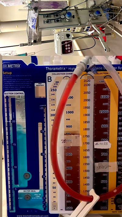 xzot1_met4xx xzot1_met4xx archive video