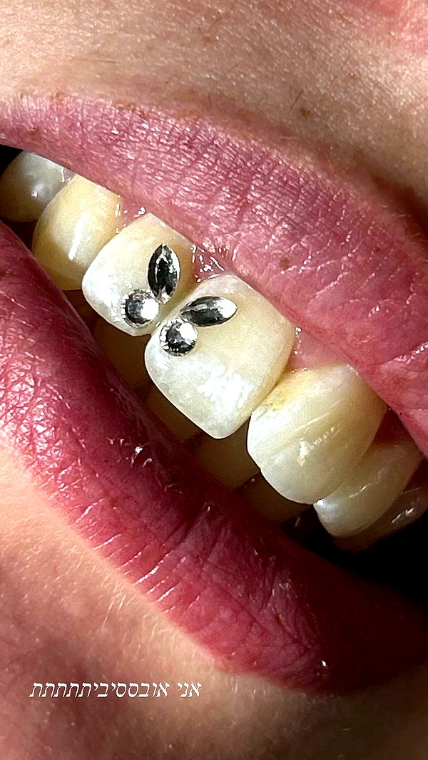 _wizardmidget_ archive video preview