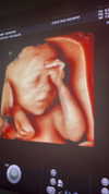 kyliejenner Altpins Profile Picture