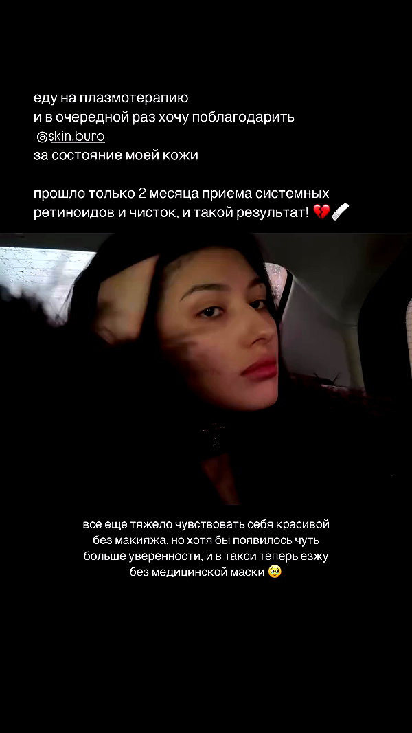 ayguldavlletova archive video preview