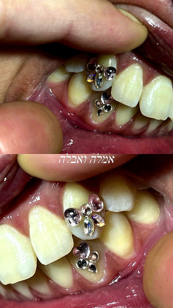 _wizardmidget_ archive video preview