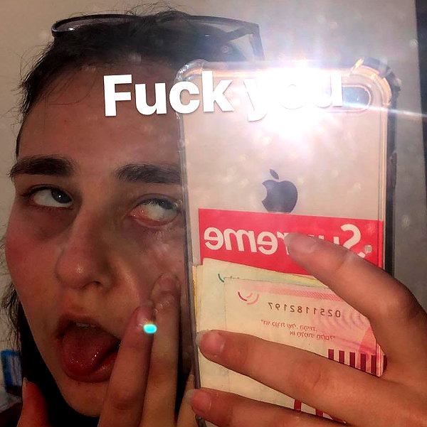 dafnudes instagram image archive image